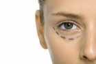 Una crema per ridurre le borse degli occhi